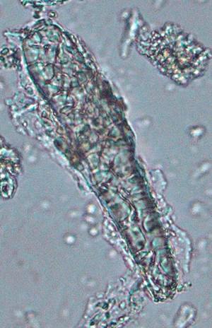 Tế bào mô cứng