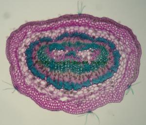 Vi phẫu cuống lá