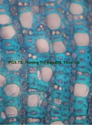 mô mềm gỗ hóa sợi