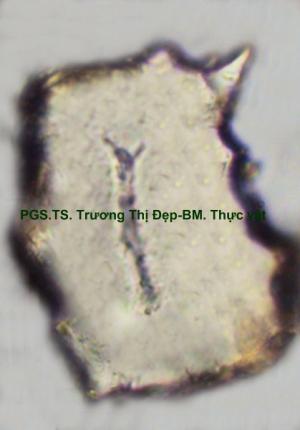 Tế bào mô cứng