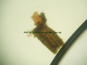 Mảnh đầu nhụy