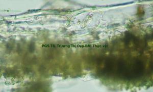 Mảnh mô mềm giậu