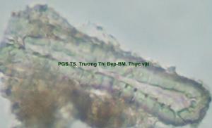 tế bào mô cứng