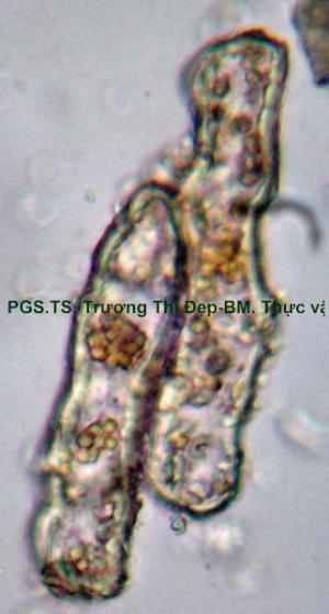 Tế bào mô cứng