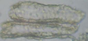 Tế bào mô cứng