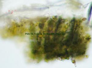 Mảnh mô mềm giậu