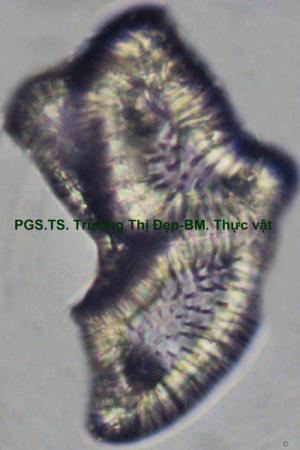 Tế bào mô cứng