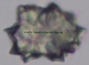 calci oxalat hình cầu gai