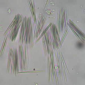 calci oxalat hình kim