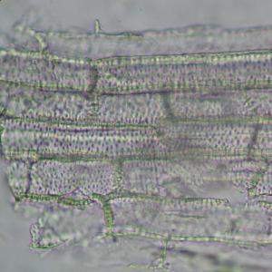 tế bào mô cứng