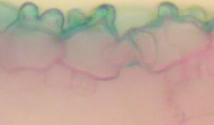 Biểu bì có cutin lồi