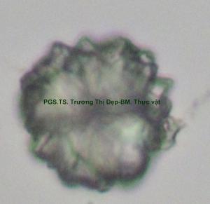 tinh thể calci oxalat