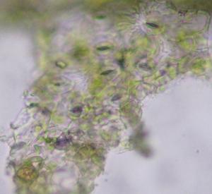 Mảnh biểu bì dưới