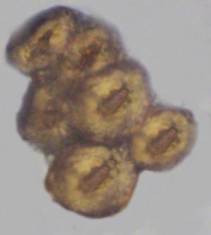 tế bào mô cứng