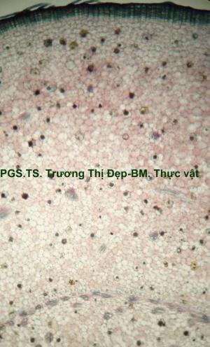 Vi phẫu thân rễ