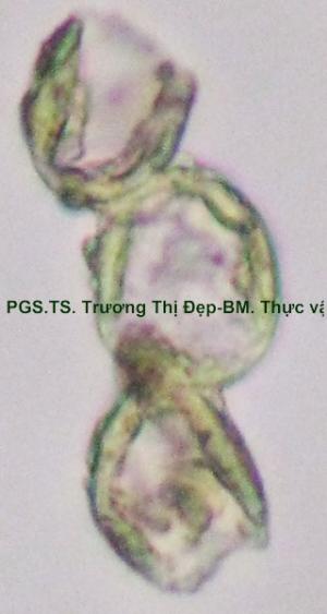 Tế bào mô cứng