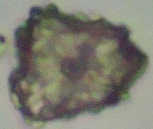 Tinh thể calci oxalat