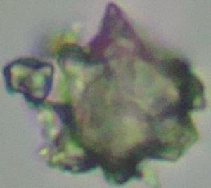 Tinh thể calci oxalat