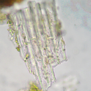 Mảnh biểu bì gân lá