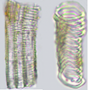 mảnh mạch xoắn