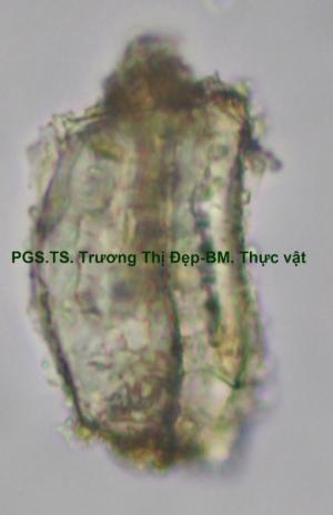 Tế bào mô cứng