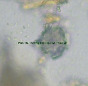 tinh thể cầu gai