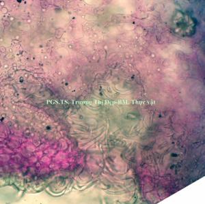 phòng ẩn lỗ khí